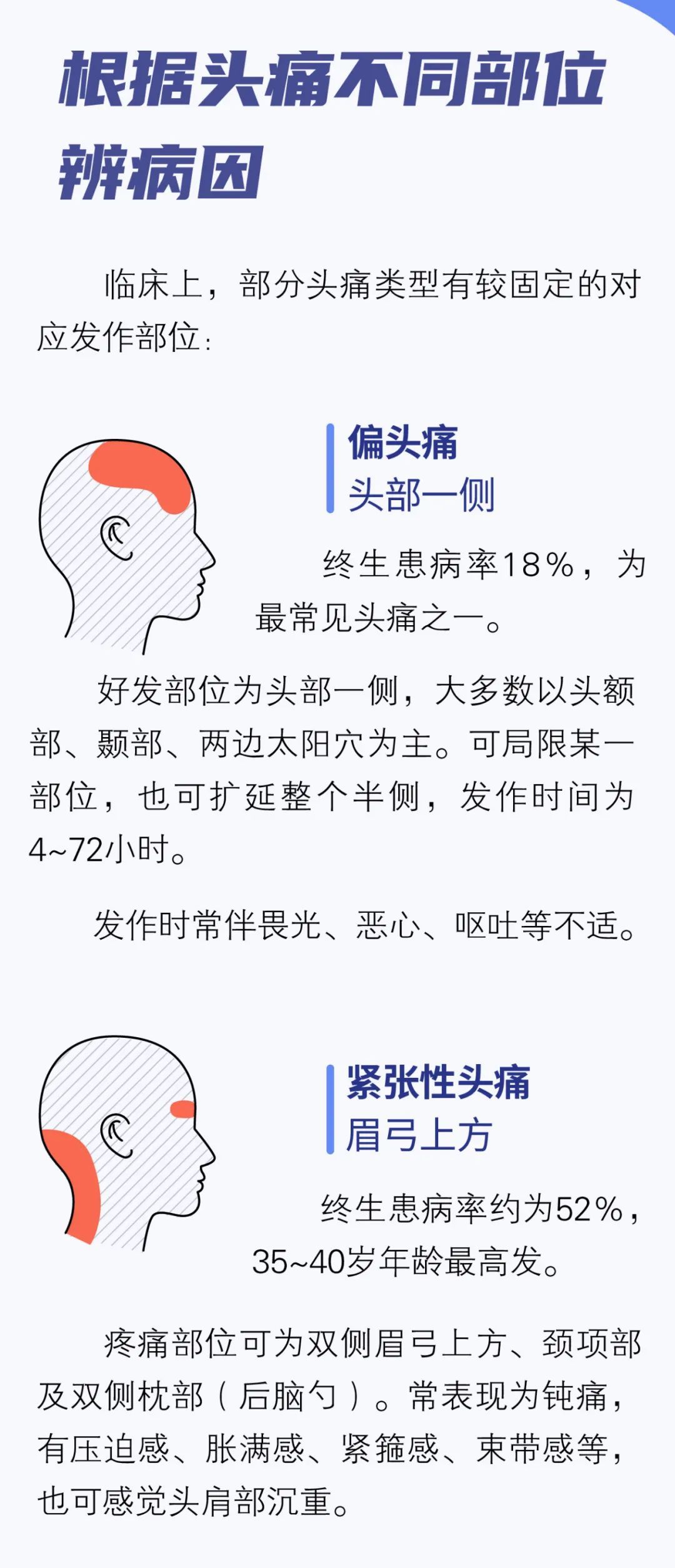 头痛千百种你的是哪种一图对照查看病因