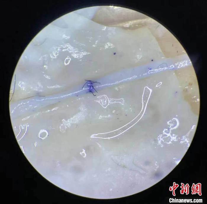 通过显微镜的视野发现，血管已被缝合十几针。　王佳 摄