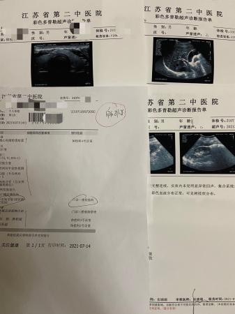 “枪手”刘洁代记者做的体检项目。