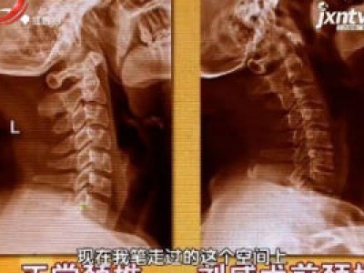 天天健康20180509