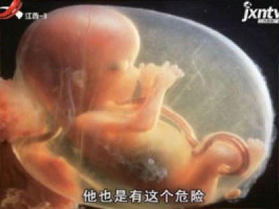 天天健康20180302