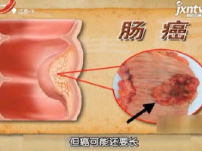 天天健康20181212