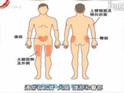天天健康20180822