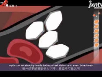 天天健康20180301