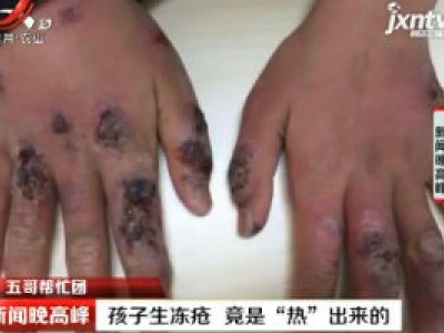 【五哥帮忙团】武汉：孩子生冻疮 竟是“热”出来的