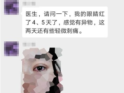 在家防“疫”突然眼红不适？别急！听专家在线解说