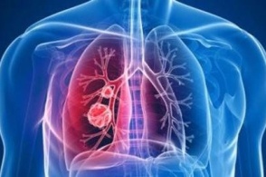 南昌市卫健委：新增确诊病例6例 累计168例 治愈20例