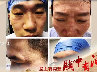 《脸上有沟壑 胸中有河山》致敬抗疫一线的医护人员