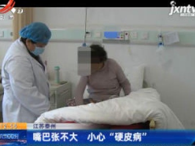江苏泰州：嘴巴张不大 小心“硬皮病”