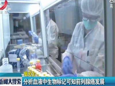 【搜民生】分析血液中生物标记可知前列腺癌发展