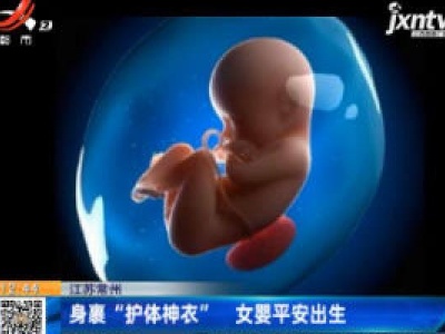 江苏常州：身裹“护体神衣” 女婴平安出生