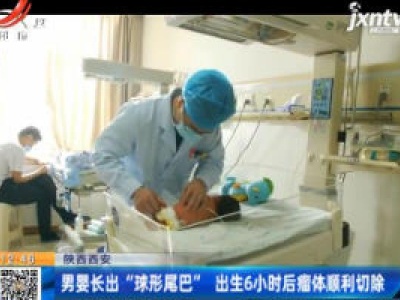 陕西西安：男婴长出“球形尾巴” 出生6小时后瘤体顺利切除