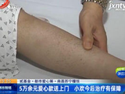 【贰基金·都市爱心筹】南昌苏宁檀悦：5万余元爱心款送上门 小欢今后治疗有保障