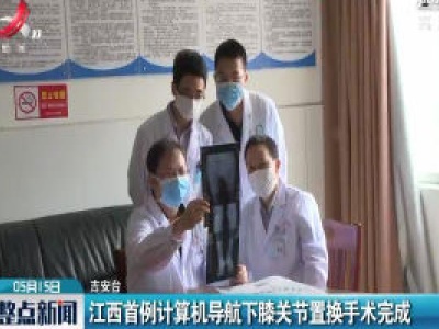 江西首例计算机导航下膝关节置换手术完成