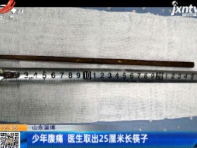 山东淄博：少年腹痛 医生取出25厘米长筷子
