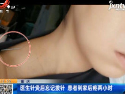 重庆：医生针灸后忘记拔针 患者到家后疼两小时