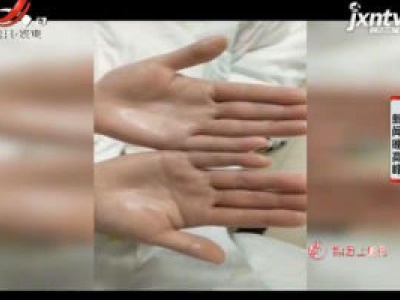 女孩手掌“流汗如雨” 竟是得到手汗症