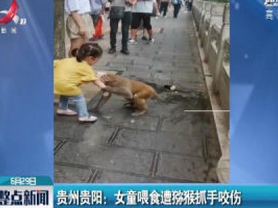 贵州贵阳：女童喂食遭猕猴抓手咬伤
