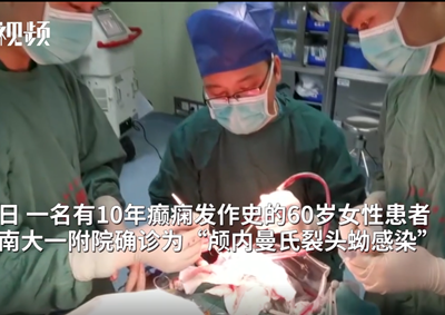 十年癫痫 发现脑子被虫“吃”了