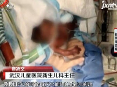 武汉：出生仅500克！ “巴掌宝宝”治愈出院