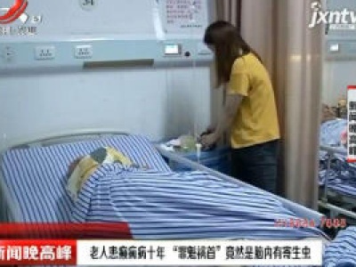 南昌：老人患癫痫病十年 “罪魁祸首”竟然是脑内有寄生虫
