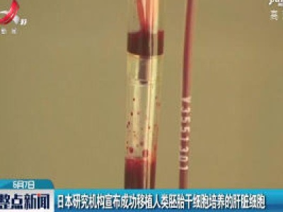 日本研究机构宣布成功移植人类胚胎干细胞培养的肝脏细胞