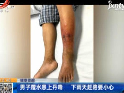 【健康提醒】广东：男子蹚水患上丹毒 下雨天赶路要小心