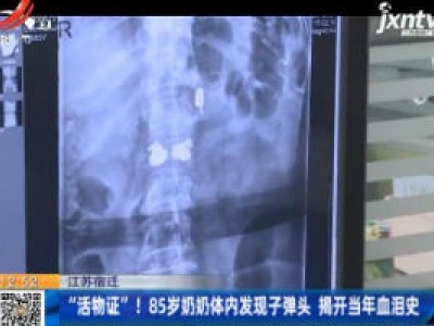 江苏宿迁：“活物证”！85岁奶奶体内发现子弹头 揭开当年血泪史