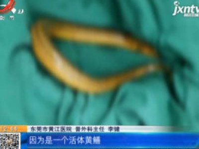 广东东莞：男子信偏方用黄鳝治便秘 险些要了自己的命