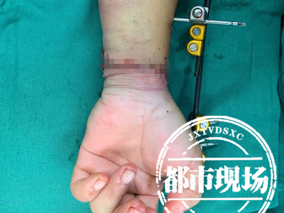 江西男子上厕所时突遭意外，整个人被“钉在”地上