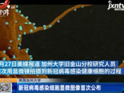 美国加州大学：新冠病毒感染细胞显微图像首次公布