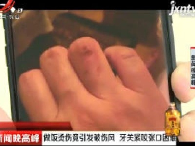 北京：做饭烫伤竟引发破伤风 牙关紧咬张口困难