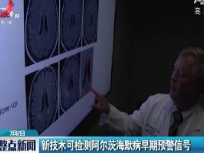 新技术可检测阿尔茨海默病早期预警信号