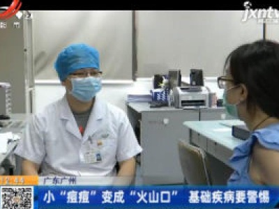 广东广州：小“痘痘”变成“火山口”  基础疾病要警惕