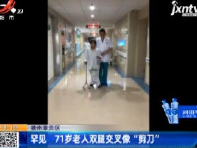 赣州章贡区：罕见 71岁老人双腿交叉像“剪刀”