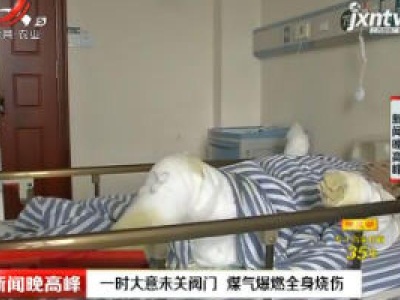南昌：一时大意未关阀门 煤气爆燃全身烧伤