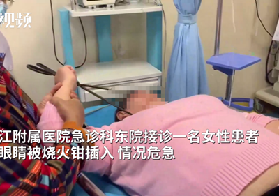 看着都疼！九江一女子被火钳插入眼睛