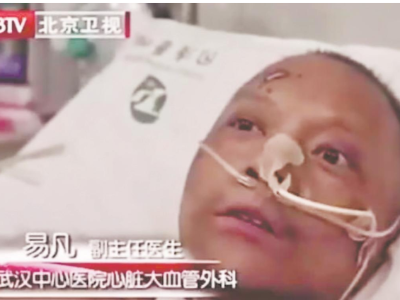 曾患新冠的黑脸医生易凡白回来了！