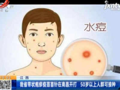 江西：我省带状疱疹疫苗首针在南昌开打 50岁以上人群可接种