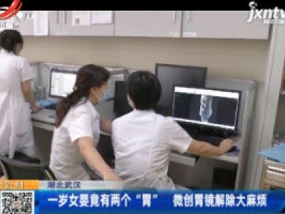 湖北武汉：一岁女婴竟有两个“胃”  微创胃镜解除大麻烦