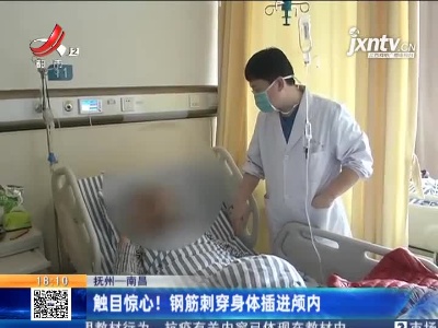 抚州—南昌：触目惊心！钢筋刺穿身体插进颅内