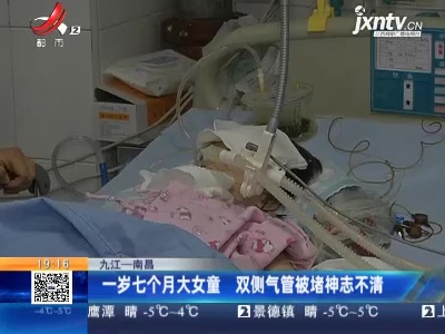 九江—南昌：一岁七个月大女童 双侧气管被堵神志不清