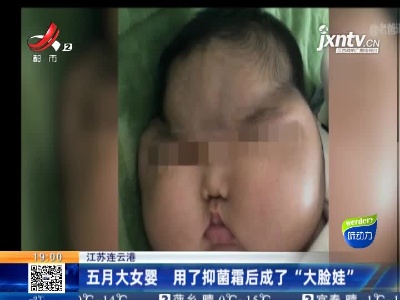 江苏连云港：五月大女婴 用了抑菌霜后成了“大脸娃”