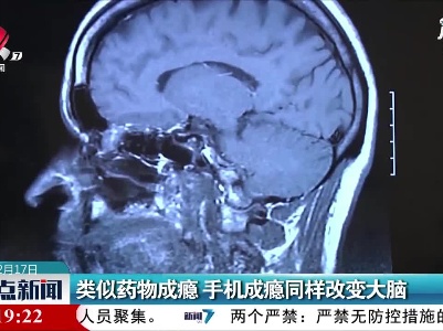 类似药物成瘾 手机成瘾同样改变大脑