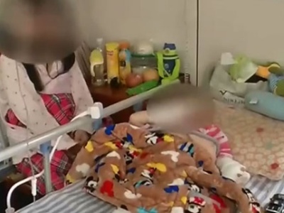 南昌：手扶电梯上出意外 三岁男童三根手指被夹断！