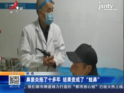 南昌：鼻窦炎拖了十多年 结果变成了“蛙鼻”