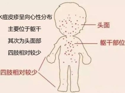 江西人注意！这五种疾病进入高发期
