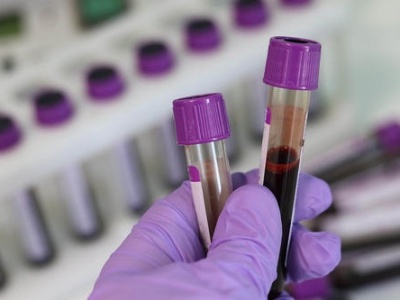 南昌公布12个DNA血样采集点 市民可免费采血比对找寻失散亲人