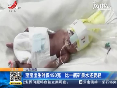 山东济南：宝宝出生时仅450克 比一瓶矿泉水还要轻