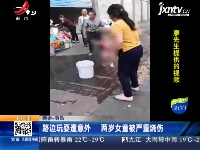 新余—南昌：路边玩耍遭意外 两岁女童被严重烧伤